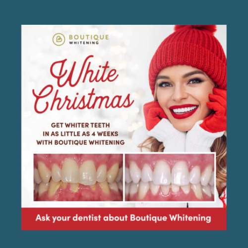 O femeie zâmbind cu dinți albi impecabili (rezultat Boutique Whitening) purtând o căciulă de Crăciun, alături de imagini înainte/după tratamentul de albire, promovând ofertele de £199 și £399 de la AC Dentartis.